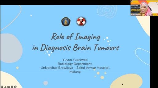 Guest Lecture from Prof. Dr. dr. Yuyun Yueniwati, M.Kes, Sp.Rad(K)
